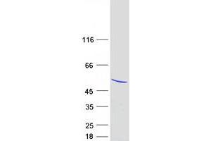 Western Blotting (WB) image for High-Mobility Group 20A (HMG20A) protein (Myc-DYKDDDDK Tag) (ABIN2722865)