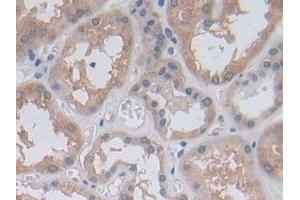 Immunohistochemistry (IHC) image for anti-Methylenetetrahydrofolate Reductase (NAD(P)H) (MTHFR) (AA 1-325) antibody (ABIN7436504)