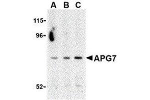 Western Blotting (WB) image for anti-ATG7 Autophagy Related 7 (ATG7) (C-Term) antibody (ABIN2477539) (ATG7 抗体  (C-Term))