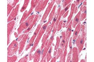 Anti-SERTAD1 antibody IHC of human heart. (SERTAD1 抗体  (N-Term))