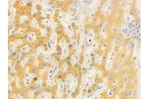 ABIN6262446 and ABIN6278479 at 1/100 staining human normal liver tissue by IHC-P. (IDH3B 抗体  (N-Term))