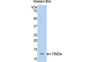 Western blot analysis of the recombinant protein. (Annexin IV 抗体  (AA 165-260))