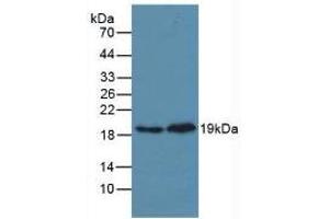 Western blot analysis of (1) Mouse Heart Tissue and (2) Rat Heart Tissue. (MAPK14 抗体  (AA 19-279))