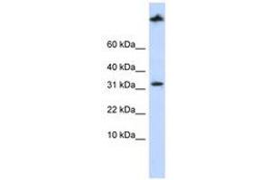 Image no. 1 for anti-Sterol Carrier Protein 2 (SCP2) (AA 144-193) antibody (ABIN6741390) (SCP2 抗体  (AA 144-193))