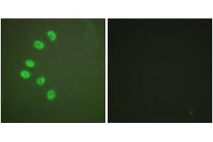 Immunofluorescence analysis of A549 cells, using Progesterone Receptor (Ab-294) Antibody. (Progesterone Receptor 抗体  (AA 261-310))
