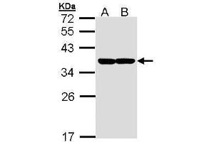 WB Image Sample (30 ug of whole cell lysate) A: Molt-4 , B: Raji 12% SDS PAGE antibody diluted at 1:1000 (XBP1 抗体)