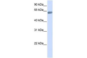 SLC47A2 antibody used at 1 ug/ml to detect target protein. (SLC47A2 抗体  (C-Term))
