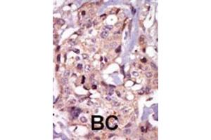 Immunohistochemistry (Paraffin-embedded Sections) (IHC (p)) image for anti-Nuclear Receptor Subfamily 4, Group A, Member 3 (NR4A3) (AA 175-205) antibody (ABIN392111)