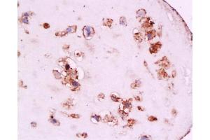 Formalin-fixed and paraffin embedded human placenta tissue labeled with Anti-CD105 Polyclonal Antibody, Unconjugated at 1:200, followed by conjugation to the secondary antibody and DAB staining (Endoglin 抗体  (AA 601-658))
