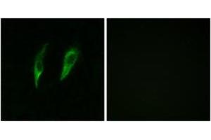 Immunofluorescence analysis of HeLa cells, using IRAK3 Antibody. (IRAK3 抗体  (AA 491-540))