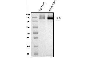 Western blot analysis of BMPR2 using anti-BMPR2 antibody (ABIN7601062).