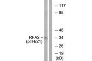 Western blot analysis of extracts from HeLa cells treated with Adriamycin 0. (RPA2 抗体  (pThr21))