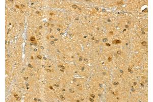 ABIN6265848 and ABIN6277175 at 1/100 staining Rat brain tissue by IHC-P. (UBE2I 抗体  (N-Term))