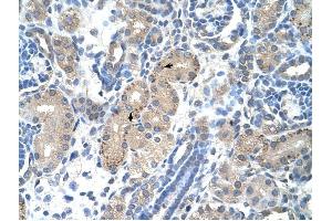 FOXR2 antibody was used for immunohistochemistry at a concentration of 2. (FOXR2 抗体  (N-Term))