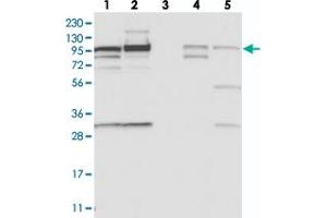 Western blot analysis of Lane 1: RT-4, Lane 2: U-251 MG, Lane 3: Human Plasma, Lane 4: Liver, Lane 5: Tonsil with SCARF2 polyclonal antibody  at 1:250-1:500 dilution. (SCARF2 抗体)