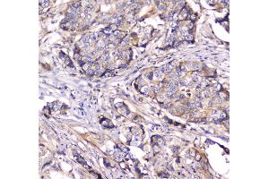 IHC analysis of Dynamin 1 using anti-Dynamin 1 antibody . (Dynamin 1 抗体  (AA 616-667))