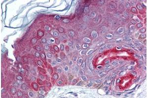 Human Skin (formalin-fixed, paraffin-embedded) stained with FAM3C antibody ABIN293839 at 5-10 ug/ml followed by biotinylated goat anti-rabbit IgG secondary antibody ABIN481713, alkaline phosphatase-streptavidin and chromogen. (FAM3C 抗体  (AA 40-80))
