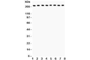 Western blot testing of Integrin alpha 5 antibody and Lane 1:  rat brain;  2: mouse brain;  3: human MM231;  4: (h) HeLa;  5: (h) Jurkat;  6: (h) 293T;  7: (m) Neuro-2a;  8: (r) PC12 lysate;  Expected size: 115-160KD;  Observed size: 220KD (ITGA5 抗体  (AA 787-992))