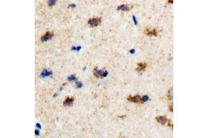 Immunohistochemical analysis of EFHC1 staining in rat brain formalin fixed paraffin embedded tissue section. (EFHC1 抗体)