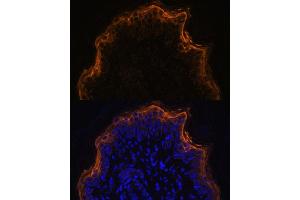 Immunofluorescence analysis of rat skin using SPRR1A antibody (ABIN7270369) at dilution of 1:100. (SPRR1A 抗体)