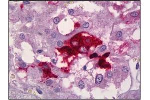 Immunohistochemistry (IHC) image for anti-Neuropeptide Y (NPY) antibody (ABIN953680) (NPY 抗体)