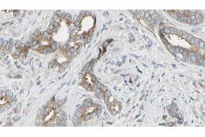 ABIN6276516 at 1/100 staining Human prostate tissue by IHC-P. (ARHGEF7 抗体  (Internal Region))