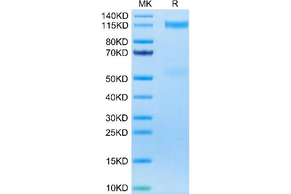 IGF1R Protein (AA 31-932) (His-Avi Tag)