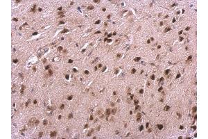 IHC-P Image VHL antibody detects VHL protein at cytosol and nucleus on mouse fore brain by immunohistochemical analysis. (VHL 抗体)