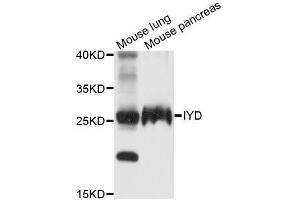 Western blot analysis of extracts of various cell lines, using IYD antibody (ABIN5996813) at 1/1000 dilution. (IYD 抗体)
