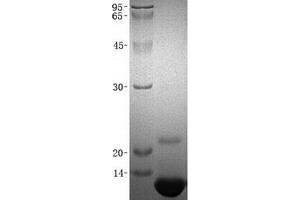 Validation with Western Blot (CCL8 蛋白)