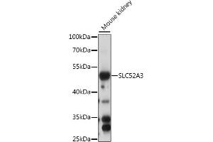 Western blot analysis of extracts of mouse kidney, using SLC52 antibody (ABIN7270472) at 1:1000 dilution. (Solute Carrier Family 52 (Riboflavin Transporter), Member 3 (SLC52A3) (AA 200-300) 抗体)