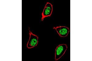 Immunofluorescence (IF) image for anti-Proliferating Cell Nuclear Antigen (PCNA) (AA 231-261), (C-Term) antibody (ABIN389344)
