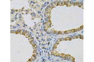 Immunohistochemistry of paraffin-embedded Mouse lung using CDA Polyclonal Antibody at dilution of 1:100 (40x lens).