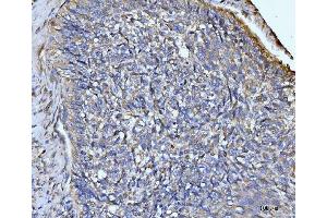 IHC analysis of GLUL using anti-GLUL antibody (ABIN7602403).