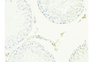 ABIN6276968 at 1/100 staining Mouse testis tissue by IHC-P. (ACPP 抗体  (Internal Region))