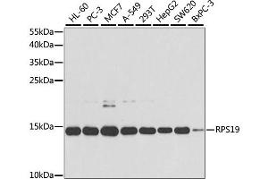 Western blot analysis of extracts of various cell lines, using RPS19 antibody (ABIN1874653) at 1:1000 dilution. (RPS19 抗体)