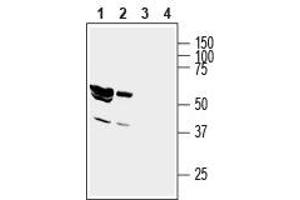 Western blot analysis of rat brain lysate (lanes 1 and 3) and mouse brain membranes (lanes 2 and 4): - 1,2. (GIPC1 抗体  (Intracellular, N-Term))