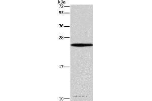 Western blot analysis of 231 cell, using GUK1 Polyclonal Antibody at dilution of 1:400 (GUK1 抗体)