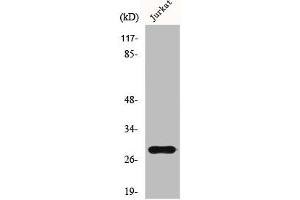 Western Blot analysis of Jurkat cells using GSTT1/4 Polyclonal Antibody (GSTT1 抗体  (N-Term))