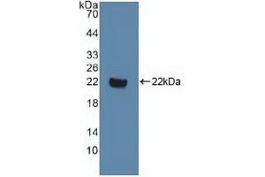 Western blot analysis of recombinant Human DVL1. (DVL1 抗体  (AA 150-285))