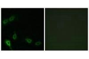 Immunofluorescence analysis of A549 cells, using MARK2 antibody. (MARK2 抗体  (N-Term))