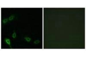 Immunofluorescence analysis of A549 cells, using MARK2 antibody.