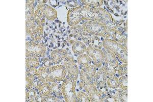 Immunohistochemistry (Paraffin-embedded Sections) (IHC (p)) image for anti-Adaptor-Related Protein Complex 2, alpha 1 Subunit (AP2A1) (AA 1-260) antibody (ABIN6136952)