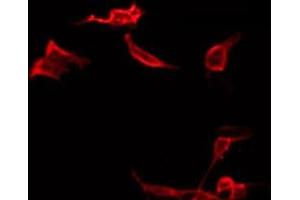ABIN6266572 staining LOVO by IF/ICC. (Cytokeratin 19 抗体  (Internal Region))