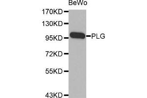 Western blot analysis of extracts of BeWo cell line, using PLG antibody. (PLG 抗体  (AA 20-300))
