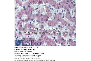 Immunohistochemistry (IHC) image for anti-Solute Carrier Family 27 (Fatty Acid Transporter), Member 2 (SLC27A2) (N-Term) antibody (ABIN2781594)