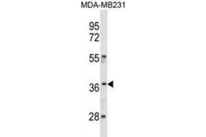 Western Blotting (WB) image for anti-Homeobox C10 (HOXC10) antibody (ABIN3001305) (HOXC10 抗体)