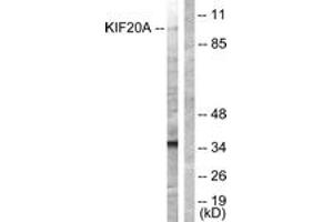 Western blot analysis of extracts from 293 cells, using KIF20A (Ab-528) Antibody. (KIF20A 抗体  (AA 501-550))