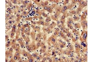 Immunohistochemistry of paraffin-embedded human liver tissue using ABIN7168659 at dilution of 1:100 (SEC23IP 抗体  (AA 779-989))