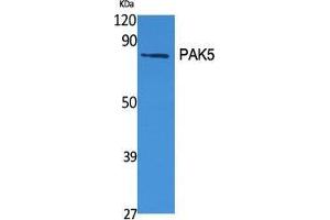 Western Blot (WB) analysis of specific cells using PAK5 Polyclonal Antibody. (PAK7 抗体  (C-Term))